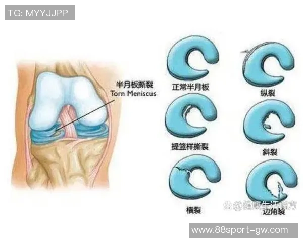 加比亚左膝过度伸展受伤情况更新已排除韧带和半月板损伤风险